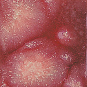 Cranberry Burst Crystalites - 4 OZ, Ceramic Supplies